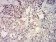 IDH2 Primary Antibody MP31666  [M3E8E9]
