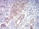 ACSS1 Primary Antibody MP31681  [M3A7C1]