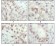 CHK2 Primary Antibody MP20223 [M1C12B8]
