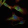 RICTOR Primary Antibody MP30090 [M7B3]