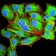 SERPINA1 Primary Antibody MP30982 [M5D1D2]